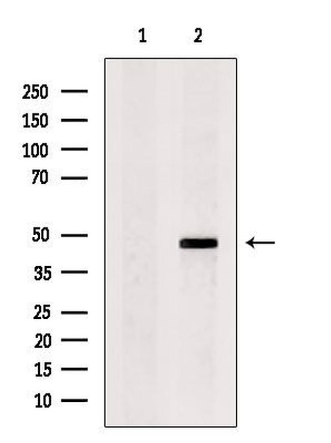 KCNK12 Antibody in Western Blot (WB)