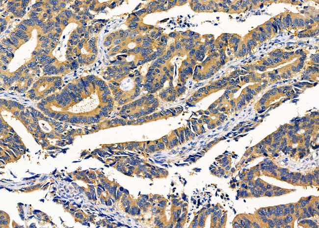 KCNK17 Antibody in Immunohistochemistry (Paraffin) (IHC (P))