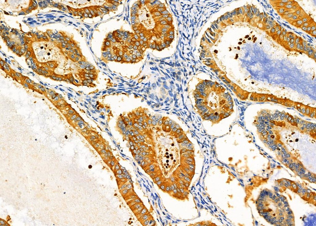 KCNK17 Antibody in Immunohistochemistry (Paraffin) (IHC (P))