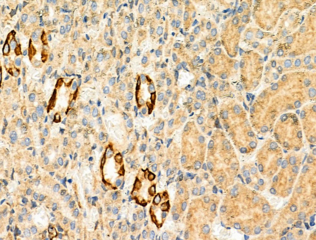 KV1.5 (KCNA5) Antibody in Immunohistochemistry (Paraffin) (IHC (P))