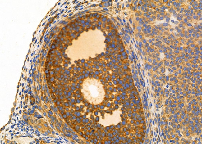 KV1.5 (KCNA5) Antibody in Immunohistochemistry (Paraffin) (IHC (P))