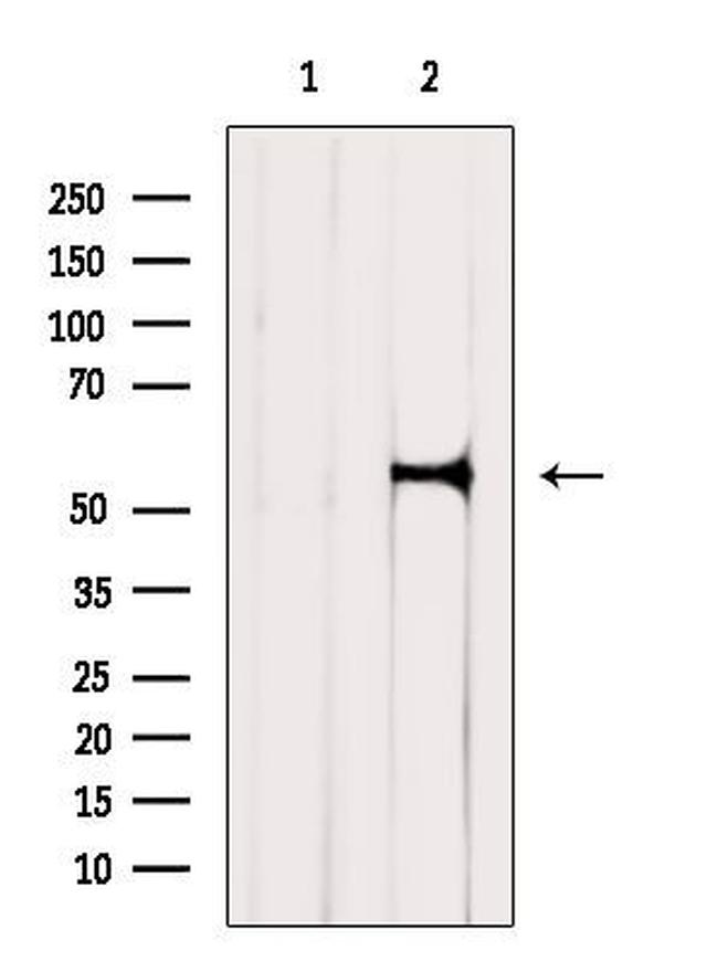 KCNF1 Antibody in Western Blot (WB)