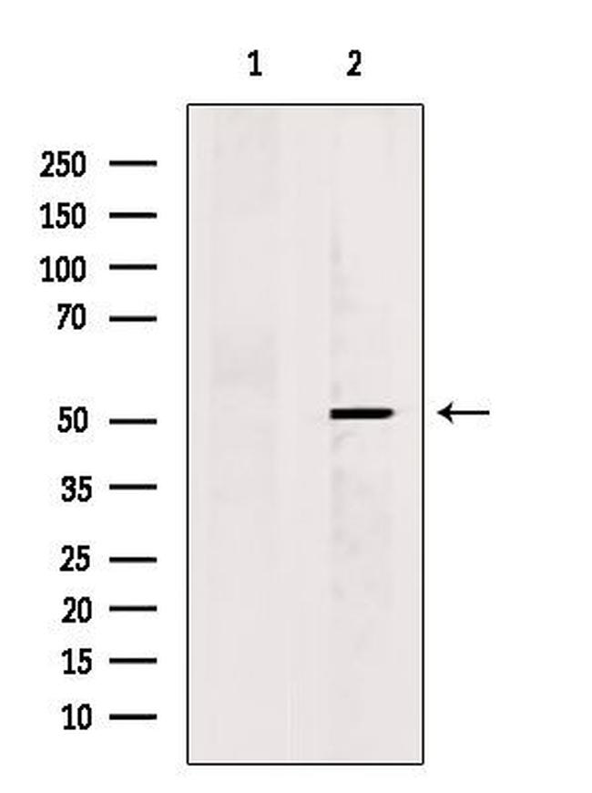 KCNG2 Antibody in Western Blot (WB)