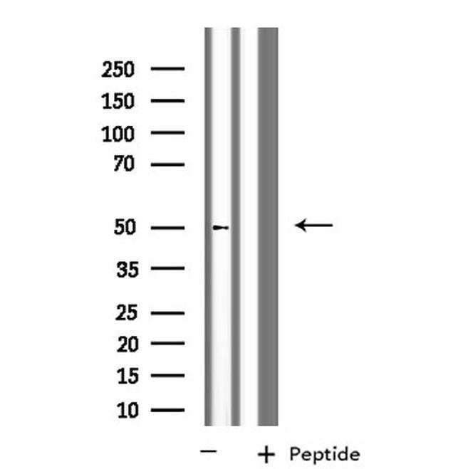 KCNG2 Antibody in Western Blot (WB)