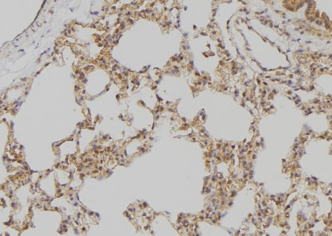 APOBEC3D/APOBEC3F Antibody in Immunohistochemistry (Paraffin) (IHC (P))