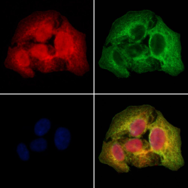 SSH3 Antibody in Immunocytochemistry (ICC/IF)