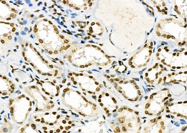 SSH3 Antibody in Immunohistochemistry (Paraffin) (IHC (P))