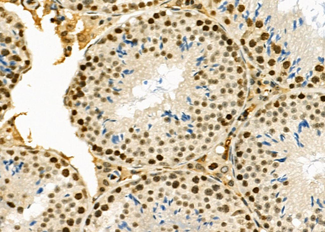 SSH3 Antibody in Immunohistochemistry (Paraffin) (IHC (P))