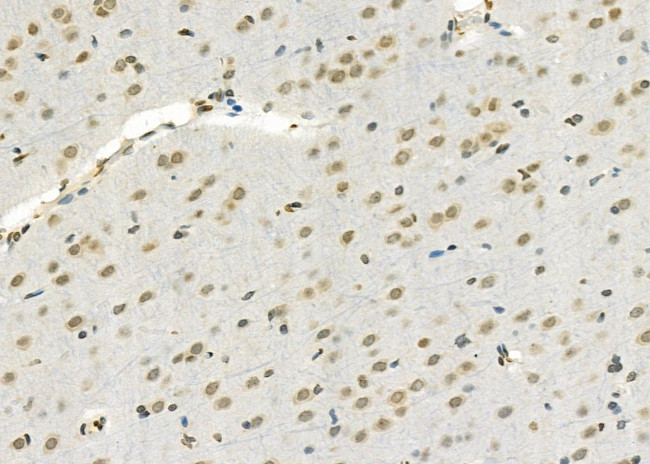 SSH3 Antibody in Immunohistochemistry (Paraffin) (IHC (P))