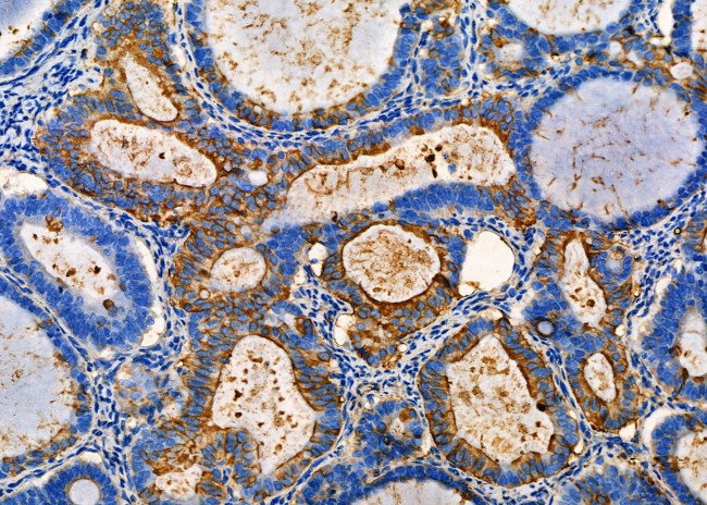 S100A5 Antibody in Immunohistochemistry (Paraffin) (IHC (P))