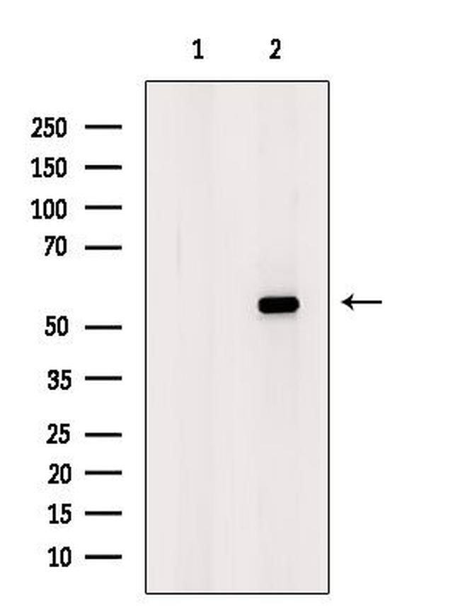 S100A5 Antibody in Western Blot (WB)