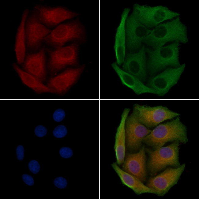 S100A7L2 Antibody in Immunocytochemistry (ICC/IF)