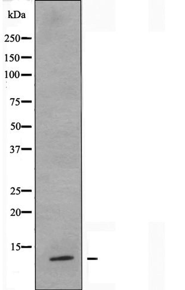 S100Z Antibody in Western Blot (WB)