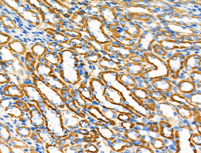 PDHA1 Antibody in Immunohistochemistry (Paraffin) (IHC (P))