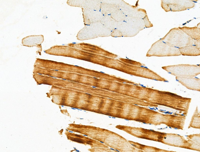 PDHA1 Antibody in Immunohistochemistry (Paraffin) (IHC (P))