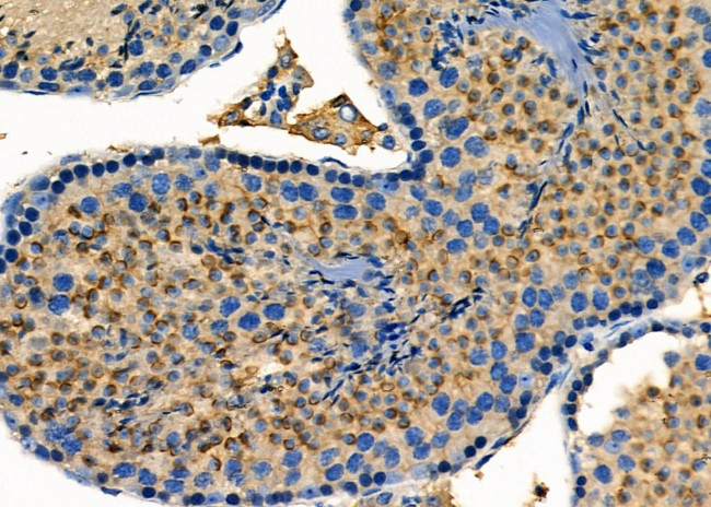 RABEP2 Antibody in Immunohistochemistry (Paraffin) (IHC (P))