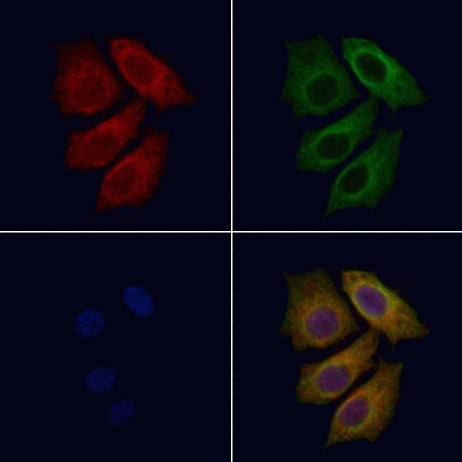 Radixin Antibody in Immunocytochemistry (ICC/IF)