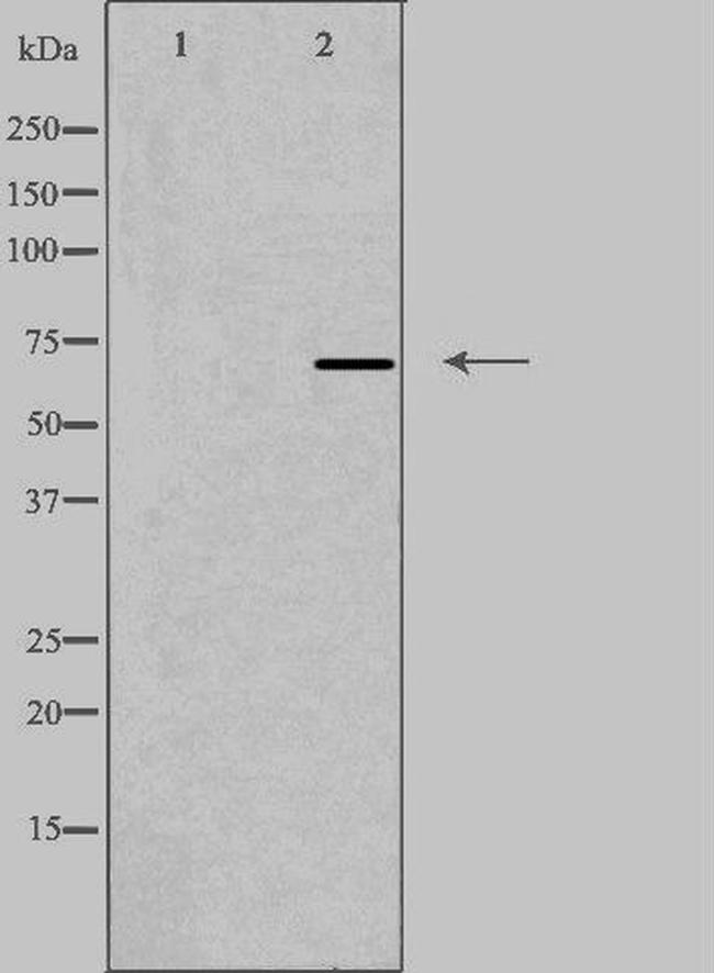 Radixin Antibody in Western Blot (WB)