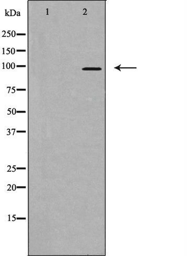 RASA3 Antibody in Western Blot (WB)