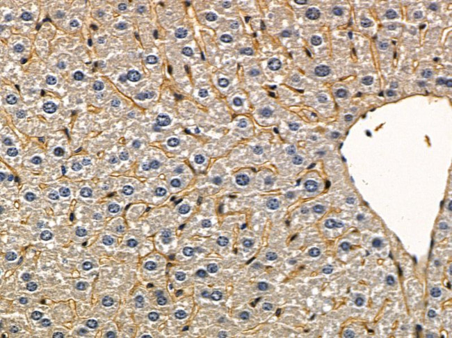 G3BP2 Antibody in Immunohistochemistry (Paraffin) (IHC (P))