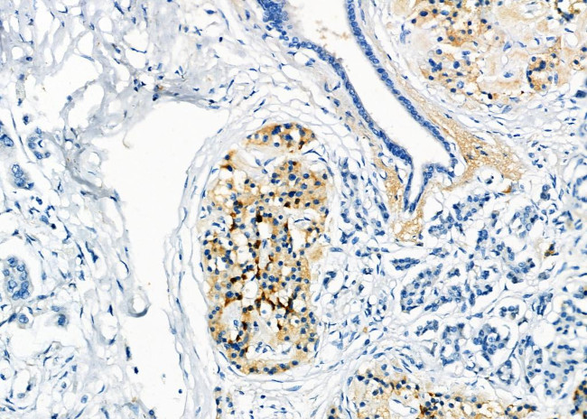 RAB20 Antibody in Immunohistochemistry (Paraffin) (IHC (P))