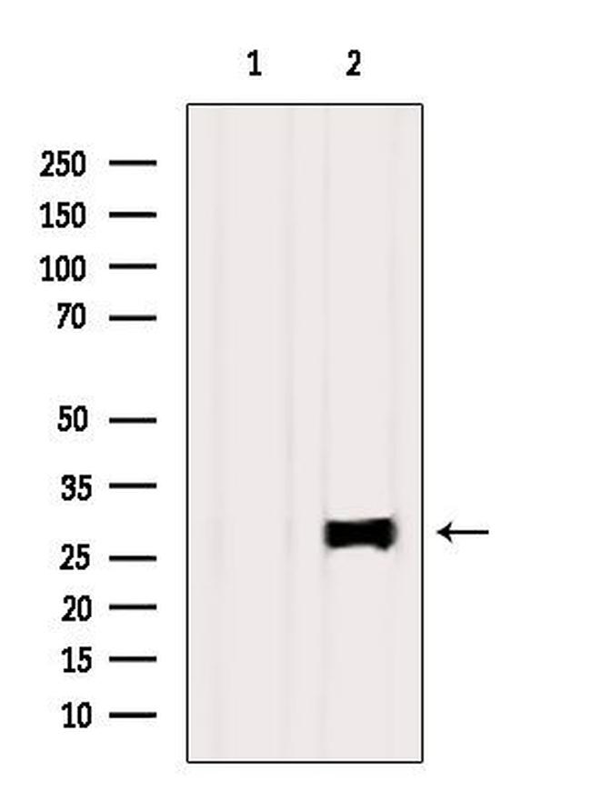 RAB20 Antibody in Western Blot (WB)