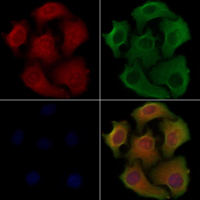 RAB37 Antibody in Immunocytochemistry (ICC/IF)