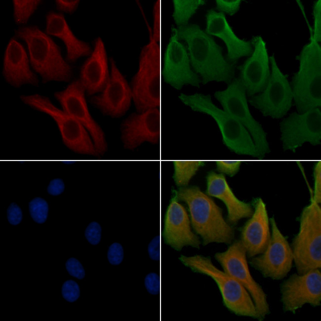 RAB5C Antibody in Immunocytochemistry (ICC/IF)