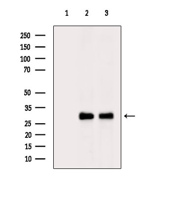 RAB5C Antibody in Western Blot (WB)