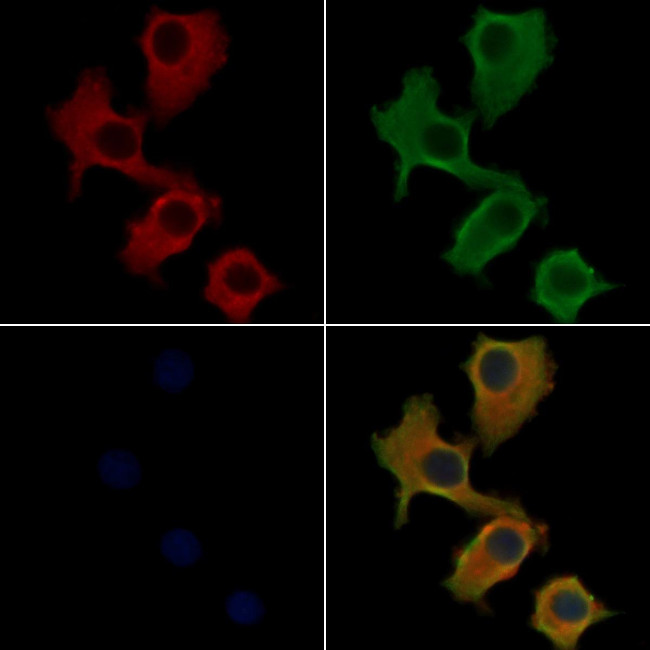 RAB6C Antibody in Immunocytochemistry (ICC/IF)