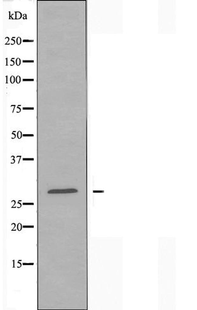 RAB6C Antibody in Western Blot (WB)