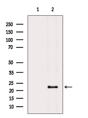 RGS5 Antibody in Western Blot (WB)