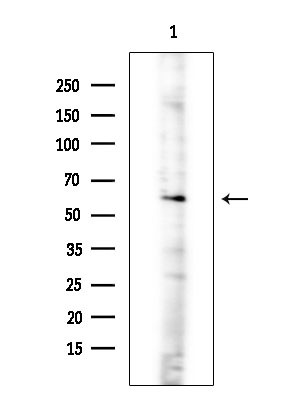 ARHGEF7 Antibody in Western Blot (WB)