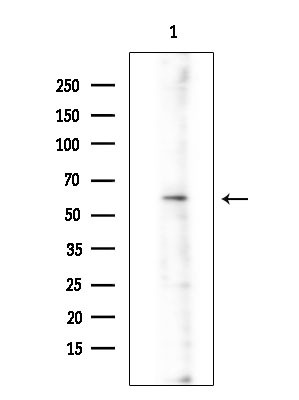 ARHGEF7 Antibody in Western Blot (WB)