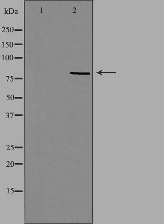 RFWD3 Antibody in Western Blot (WB)