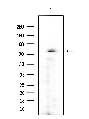 RFWD3 Antibody in Western Blot (WB)