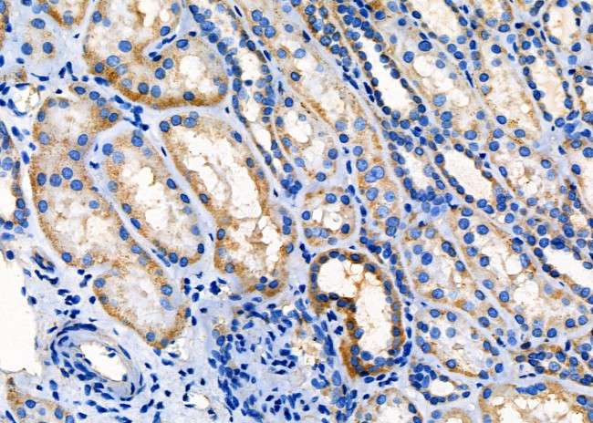 SPINK5 Antibody in Immunohistochemistry (Paraffin) (IHC (P))