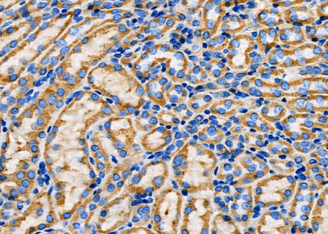 SPINK5 Antibody in Immunohistochemistry (Paraffin) (IHC (P))