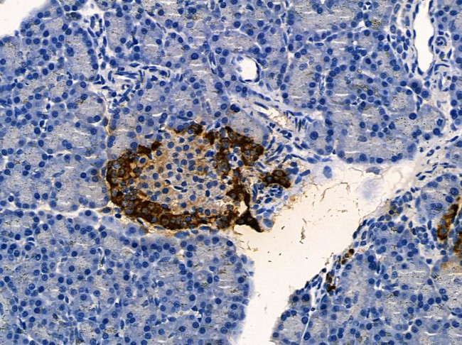 VRK2 Antibody in Immunohistochemistry (Paraffin) (IHC (P))