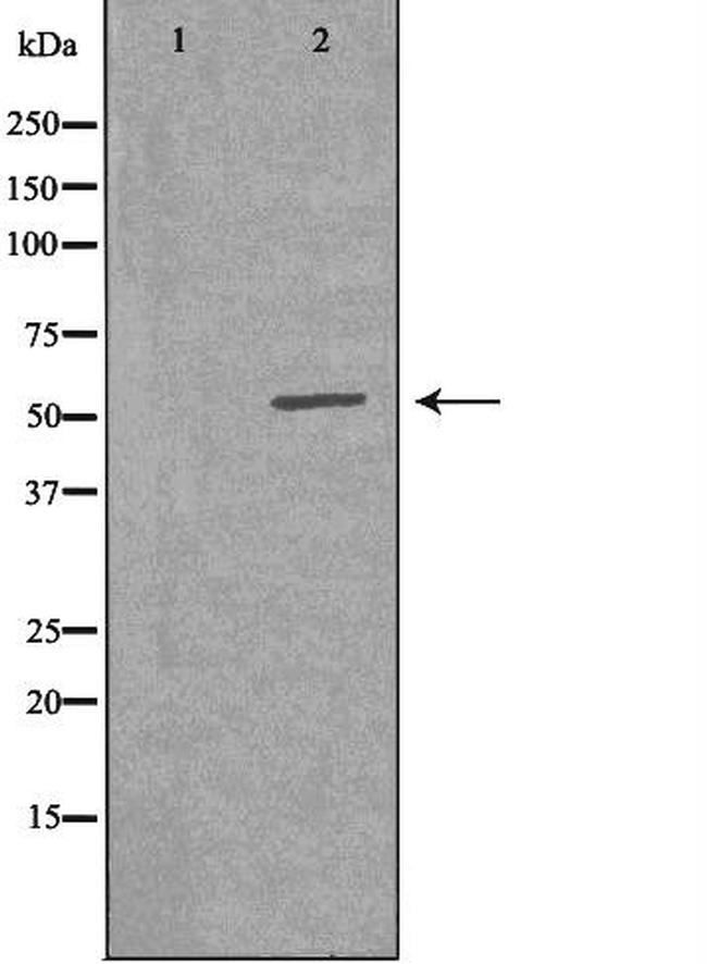 VRK2 Antibody in Western Blot (WB)