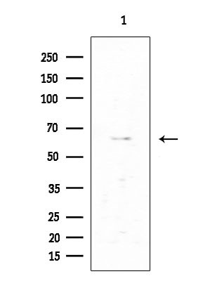 VRK2 Antibody in Western Blot (WB)