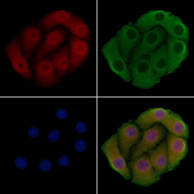 PPP2R1B Antibody in Immunocytochemistry (ICC/IF)