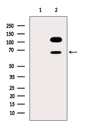 PPP2R1B Antibody in Western Blot (WB)