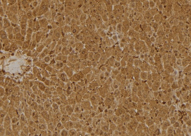 SERPINB9 Antibody in Immunohistochemistry (Paraffin) (IHC (P))