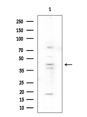 SERPINB9 Antibody in Western Blot (WB)