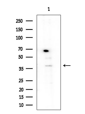 SERPINB9 Antibody in Western Blot (WB)