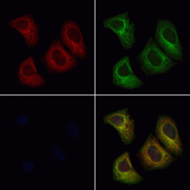 SCN4B Antibody in Immunocytochemistry (ICC/IF)