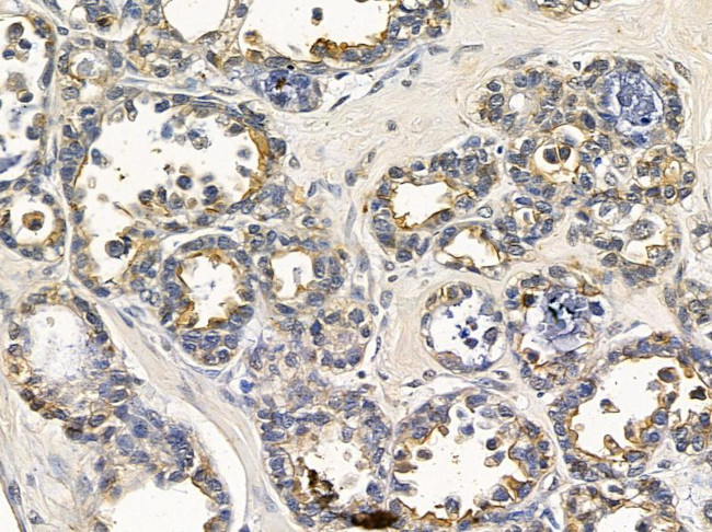 SCN4A Antibody in Immunohistochemistry (Paraffin) (IHC (P))