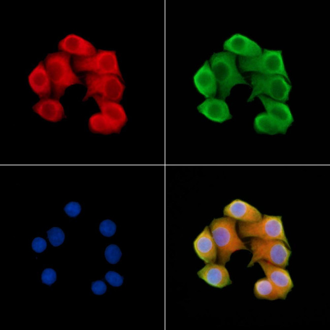 SCN2B Antibody in Immunocytochemistry (ICC/IF)