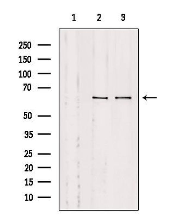 SLC9A9 Antibody in Western Blot (WB)